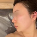 미정에스테틱 | 망포피부관리 미정에스테틱에서 두상관리 받고 작아진 후기