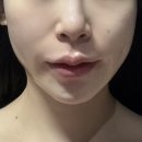 스킨트레이닝센터 - 송파구 | 김포여드름압출 스킨트레이닝센터 김포운양점 좁쌀 고민 끝!