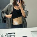 인천우리병원 | 인천 다이어트병원 마지막 후기!