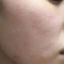 (주)비티엔 | 바디프랜드 갈바닉LED마스크 홈케어 2주차