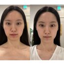 마노벨라 | 인천 남동구 웨딩관리 마노벨라스파에서 리프팅관리에 좋은 브이결 테라피 받고 온 후기