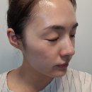 화성인셀덤 헤이븐 _ 화성피부관리 끝판왕 2주써본후기!