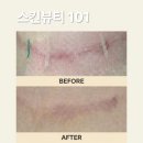 가림스킨케어 네이버블로그