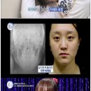 렛미인 이미지