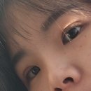 예쁜미인성형외과의원 | 팝성형외과 쌍수 눈매교정 붓기 1달경과