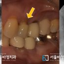 서울바정치과의원 이미지