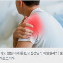 "잦은 어깨 통증 "...오십견,회전근개파열 구분법은. 이미지