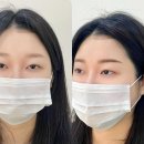 기대만족다산점 | 구리눈썹문신 리메이드 다산점 자연눈썹 방문후기 만족스러운결과