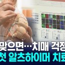 차세대 알츠하이머 치매 백신치료제 국내 최초 개발 이미지