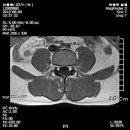 엠알아이 이미지