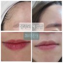 공주시 왁싱샵 저통증 천연 아로마 오일을 사용해 꼼꼼하게 시술하는 공주 르미왁싱
