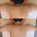 명제 한의원 | [부산 금정구] 보니또 스킨앤바디 :: 부산대 순환관리 비채나관리 등관리 바디관리 잘하는 곳 추천