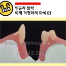 스마일기공소 이미지