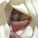 영아발달 티스토리