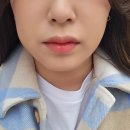 [일상] 미루고 미뤄왔던 사랑니 뺀 후기