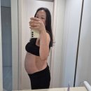 11260-1-18-36 | 36주 제왕절개 출산 후기｜해운대 제일여성병원 분만 경험 기록