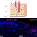 드비취일 이미지