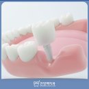 맥치과기공소 이미지