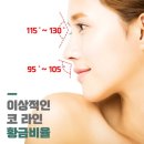 콧구멍PC방 | 압구정 비개방코성형 리얼 내돈내산 후기 1일차-2주차