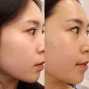 뷰티모아 | 도안동 피부관리 추천 대전 에스테틱 뷰티모아 콜라겐 리프팅 관리 후기