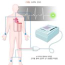 심전도 검사[electrocardiography] 이미지