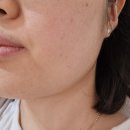 유앤아이의원 | 둔산동 피부과 유앤아이의원 대전점 제모, 잡티제거 후기