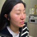 세라헤어라인 이미지