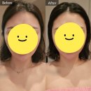 이대역 | 이대역경락 솔직후기ㅣ새라본 신촌이대본점 작은얼굴관리 베이직R 가격정보