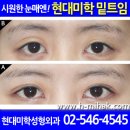 강남현대미학성형외과 Daum카페