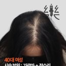 헤어팡팡 이미지