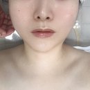 피부미인터치