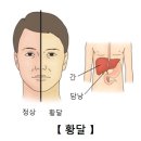 간문부 담관암(Klatskin's tumor) 이미지