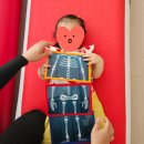 트니트니 A (12~19개월) | 허벅지 주름 비대칭, 괜찮을까요? (영유아 검진부터 세브란스 어린이병원 소아정형외과 엑스레이 후기까지)