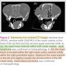 Intranasal mass lesion을 가진 79마리 고양이의 CT 특징 비교 이미지