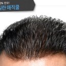 플러스모발