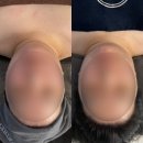 상봉빌딩 | 상봉에스테틱 에스테티아 망우역점 윤곽관리 후기