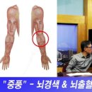 종부테라피