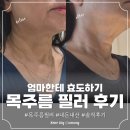 상도셋질목 | 혼주 엄마 결혼준비하기 :: 목주름 필러 내돈내산 솔직후기