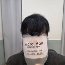 마이크로헤어증모