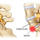 므네