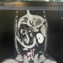 닥터서동물심장병원 | [반려견 항암] 원발부불명암(Cancer of Unknown Primary Site, CUPS. 요추하림프절 전이) 1년의 과정