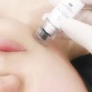 이대피부관리 이스킨뷰티 / 더마미라클 & 슈텀프 관리 받고 온 후기 !! / 이대역피부샵 / 실력좋은 원장...