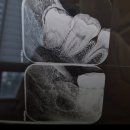 더블엠구강악안면외과치과의원 네이버블로그