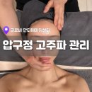글로비다 | 압구정피부관리 글로비 안티에이징센터 후기 | 압구정크레이지015 고주파관리 경험