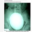 신장축산 이미지