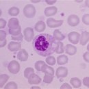 NEUTROPHIL BAND 이미지