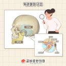 다산곧바로한의원 네이버블로그