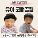 송도메디칼약국 | [육아후기] 유아 코 뼈 골절 보호대｜이비인후과 CT 촬영｜인천 송도 삼성드림이비인후과