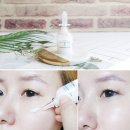 올그린메디텍 | 떨어진 피부탄력 UP~로하셀 링거 앰플 펩타 드롭샷으로 피부관리