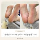 애반디뷰티 | 부천중동 발각질관리 받고 온 후기, "반디인하우스 앤 큐릭스 부천중동점" 방문 후기 :)